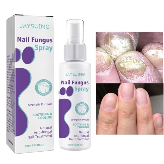 NAIL FANGUS SPRAY بخاخ الأظافر